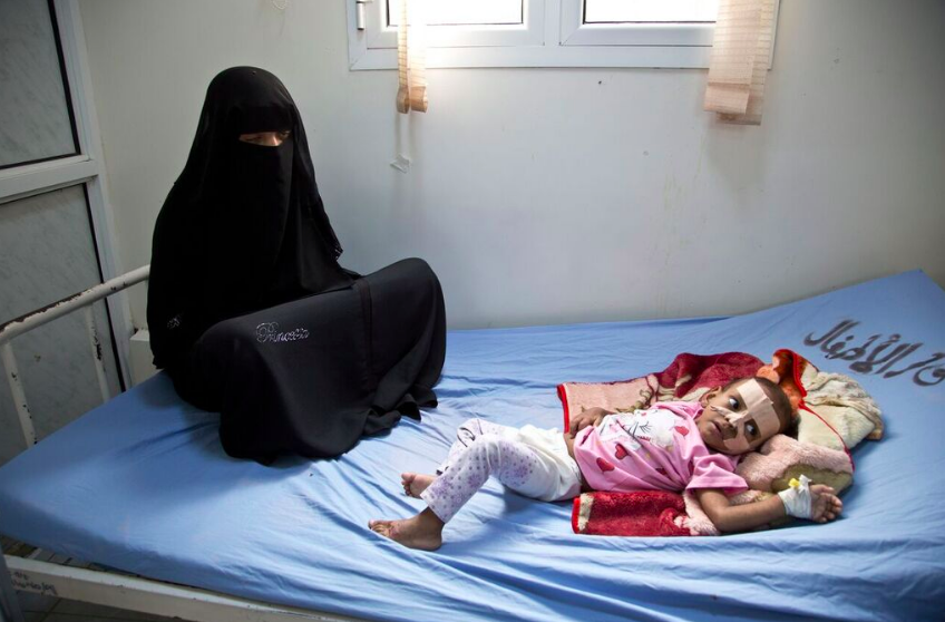 A child is treated at severe acute malnutrition treatment centre, Al Thawara Hospital, Hodeidah, Yemen, 2017