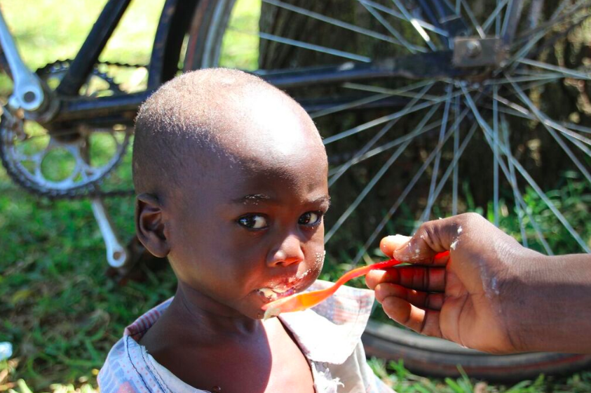 Child being treated for acute malnutrition in Malawi, 2014