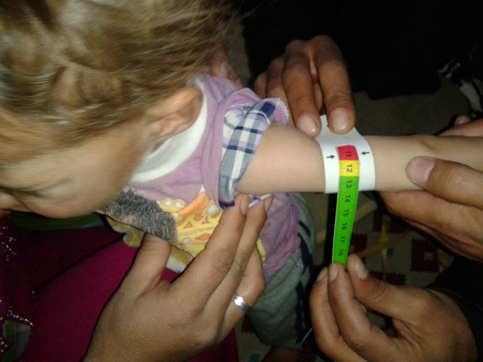 MUAC measurement during the WVI supported anthropometric assessment