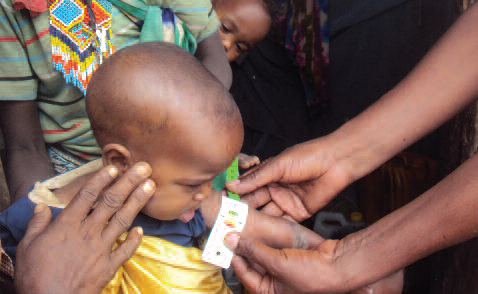A recovering OTP beneficiary at Nega Bobasa HP which benefited from an improvement of its ready to use therapeutic food supply through the donkey carts intervention