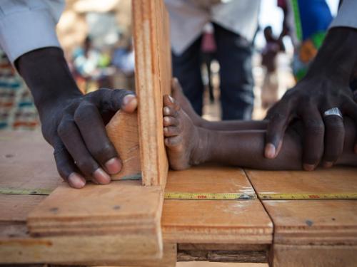 Height being measured for a stunted child
