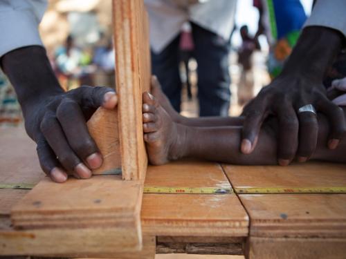 Height being measured for a stunted child