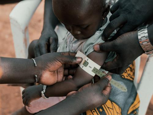 Boy getting his arm circumference measured