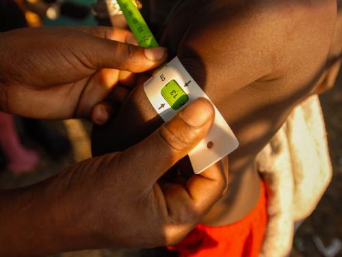 child's arm circumference being measured