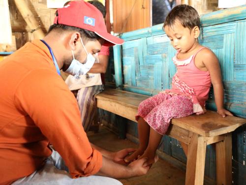 A medical professional checking a child's feet for nutritional oedema