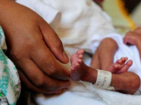 An adult's hand with a premature babys' foot