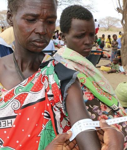 woman having her arm circumference measured
