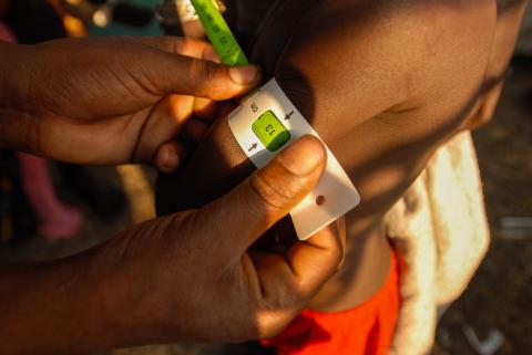 child's arm circumference being measured