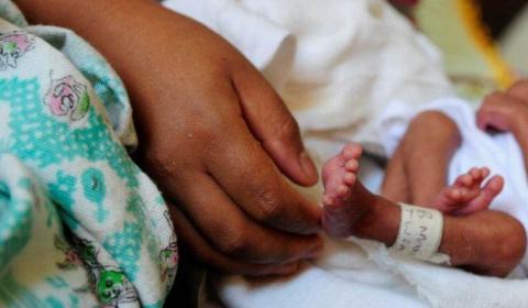 An adult's hand with a premature babys' foot