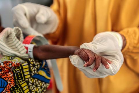 A person in medical gloves is holding the arm of a young child, measuring the mid-upper arm circumference. The measurement is far into the red area.